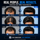 TricZen – Advanced Male Hair Regrowth Supplement