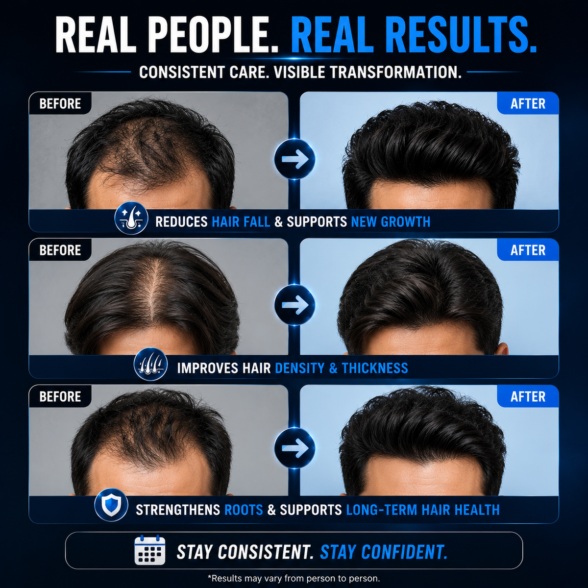 TricZen – Advanced Male Hair Regrowth Supplement